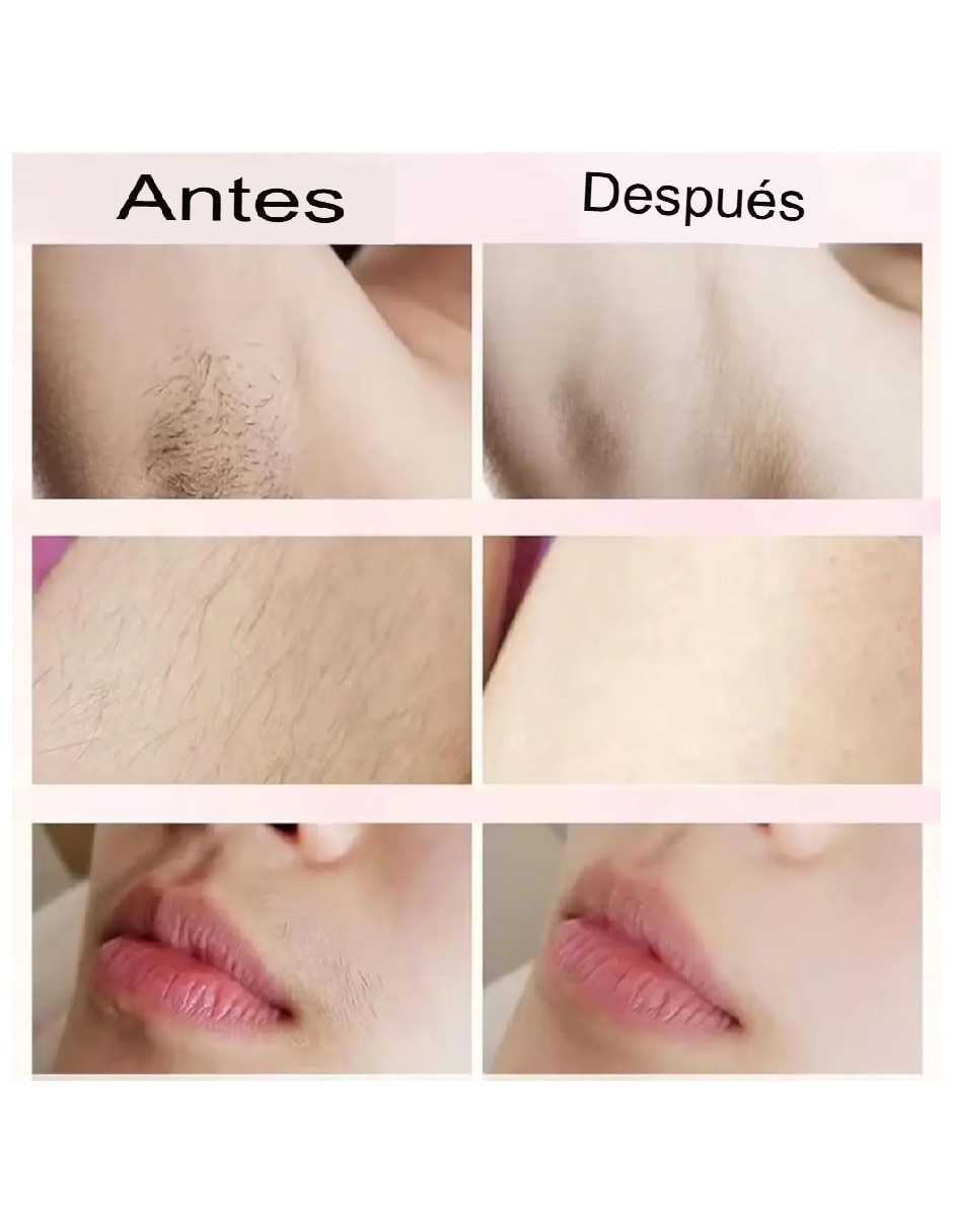 Depiladora para rostro y cuerpo Genérica 10894GU